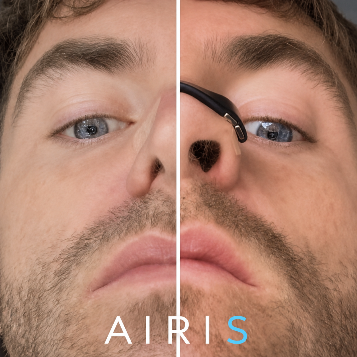 AIRIS Welcome Kit
